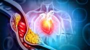 Colesterol: seis mitos peligrosos que podrían estar dañando tu salud