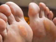 ¿Un bulto en el pie? Descubrí las 10 causas más comunes y cómo tratarlas