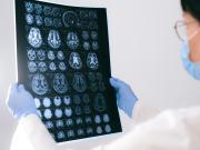 Sorpresivo hallazgo contra el Alzheimer por el efecto de dos vacunas que hoy se usan para otras enfermedades