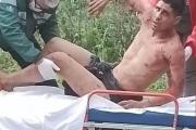 Un joven fue atacado por 15 perros tras intentar robar en una casa