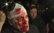 Insultos, choques, corridas y un notero herido