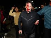 Habló Cristian Mercatante, el cronista herido en el cierre de campaña de Milei: Este impacto a un nene lo mata