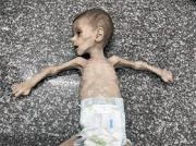 En las últimas 24 horas, 6 palestinos más pierden la vida por hambruna bajo el cruel y mortífero bloqueo israelí