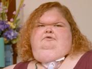 Tammy Slaton, de Kilos Mortales, bajó 234 kilos y rompió el silencio sobre un detalle en su rostro que preocupó a sus seguidores