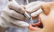 Falsos odontólogos ponen en riesgo la salud de los venezolanos: así operan estos delincuentes