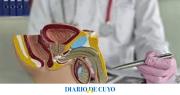 Más hombres buscan revertir la vasectomía