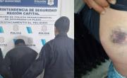 Violencia extrema en La Plata: intentó matar a su pareja y terminó preso