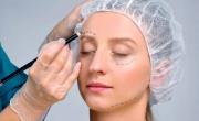 Qué es la cejaplastía, la cirugía tendencia para rejuvenecer el rostro