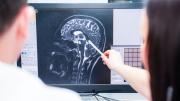 Los 3 alimentos indispensables para estimular el cerebro, según una psiquiatra de Harvard