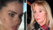 La mamá de Benjamín Vicuña habló y reveló el secreto más impactante de la China Suárez