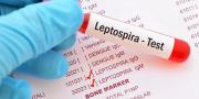 Identifican el primer caso de leptospirosis en Bolpebra, en el departamento de Pando
