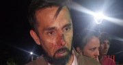 El estremecedor relato de un famoso comerciante de San Juan, golpeado junto a su familia en la plaza de su barrio