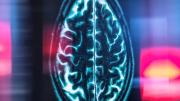 Un contador de pasos contra el Alzheimer
