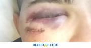 Violenta pelea entre dos familias: “Mi hijo no ve nada de un ojo, fue un intento de homicidio lo que hicieron contra nosotros”
