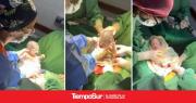 Un caso que sucede cada un millón: nacieron trigemelas