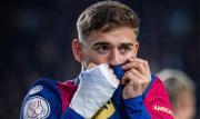 Barcelona pierde a Gavi entre cuatro y cinco meses por lesión en la rodilla