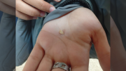 Denunciaron que había un diente en la comida de una escuela de Plottier