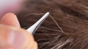 ¿Arrancar las canas? La Dra. Pascali explica las consecuencias de este procedimiento en tu cabello