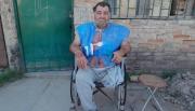Vecino con discapacidad denuncia narcomenudeo y termina quemado con agua hirviendo en Orán