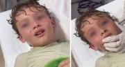 Niño sentía molestias en su oído luego de nadar en la playa y lo que encontraron los doctores dejó a todos en shock