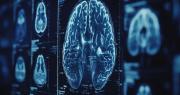 Encuentran un vínculo entre las bacterias de la boca y el Parkinson