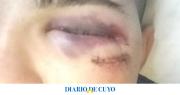 “Los que casi mataron de un ladrillazo a mi hijo son los mismos que le quebraron la mandíbula a otro chico, es hora de que hagan algo con ellos”