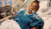 Oklahoma en shock: ¿Cómo sobrevivió la joven atacada por un pitbull tras perder brazos y piernas?