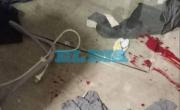 Una pareja se juntó a cenar en City Bell pero el encuentro terminó teñido de sangre: gritos, insultos y puntazo