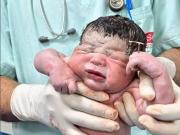 “El DIU que no me venció”: la publicación viral de la obstetra que asistió un insólito nacimiento
