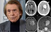 Raphael preocupa tras cancelar un nuevo concierto por enfermedad: Volveré con más fuerza que nunca