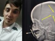 Liberó a un golpeador de niños y lo mandó a un curso de deconstruyendo masculinidades: volvió a atacar