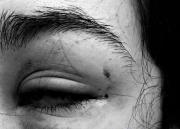 Estudiante pierde el 50% de la visión por agresión