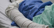 Una mujer murió quemada luego de prender un cigarrillo mientras estaba internada en Terapia Intensiva