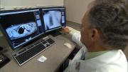 Supervivencia a cáncer de pulmón sube de 23 al 60 % con diagnóstico temprano, dice experta