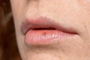 Elimina la resequedad de los labios en casa: en pocos pasos y a bajo costo prepara esta mascarilla hidratante con cuatro populares ingredientes