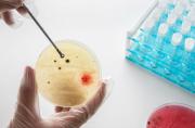 Freno a las bacterias resistentes: descubren cómo convertir el vinagre en un súper antígeno