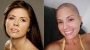 El cáncer ha vuelto: La dura confesión de la actriz Carmen Alicia Lara sobre su diagnóstico