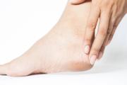 ¿Tienes los pies resecos? Prepara una crema hidratante que nutre la piel a profundidad: el gel de aloe vera es la clave