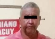 Detenido hombre que quemó a su pareja en Yaracuy porque ella quería terminar la relación