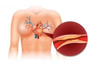 Limpia las arterias con tres ingredientes económicos rico en antioxidantes que siempre tienes en casa: así debes preparar y consumir el jugo