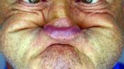 Inglaterra: un curioso concurso premia la cara “más fea” del país