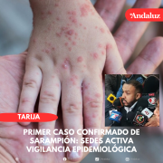 El Sedes activa vigilancia epidemiológica tras el primer caso de sarampión en Tarija