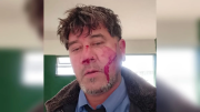 Brutal agresión a un chofer de Patagonia en la terminal