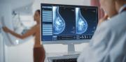 Cambian la edad a partir de la cual las mujeres bonaerenses deben hacerse la mamografía contra el cáncer de mama