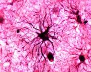 Científicos identifican la parte del cerebro que resguarda los recuerdos con carga emocional