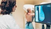 Detección de cáncer de mama: aquí la lista de los centros para mamografías sin seguro médico en EEUU