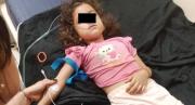 Niña estuvo a punto de morir en Lara, este animal se escondía en la toalla con la que se estaba secando