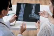 Fractura por osteoporosis: la internista Andrea Odreman da las claves para prevenir y aliviar el dolor