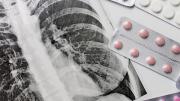 En lo que va del año se detectaron 762 casos de tuberculosis