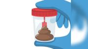 Crean banco global de heces para luchar contra la extinción de las bacterias